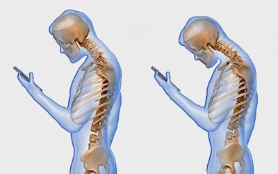 Tech Neck, Remote Work and the Modern Spine